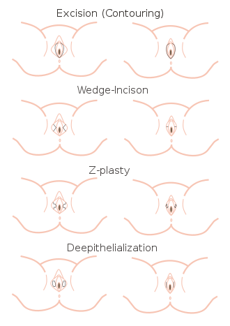 Frauengesundheitsaktivitäten tätowierung auf der vagina frauen foto 4
